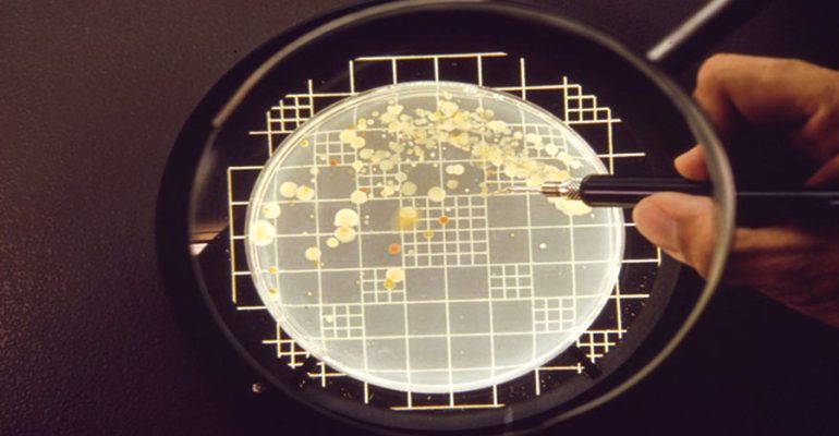 colony count