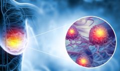 Discovery-of-a-new-drug-resistance-mechanism-in-breast-cancer-zistna-ir